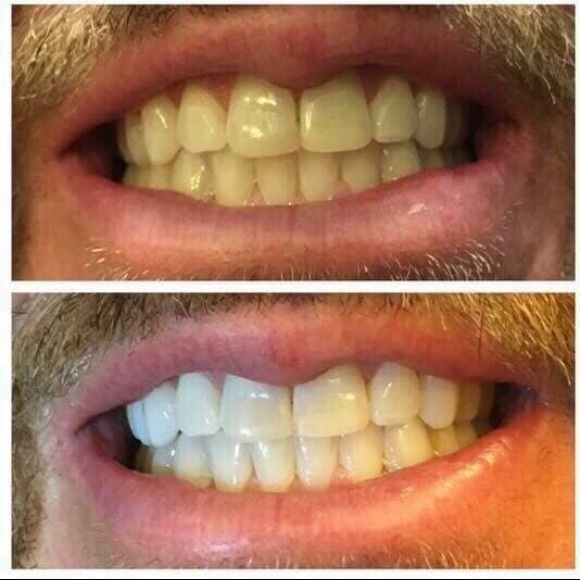 Makeup - Picture 5 of 6